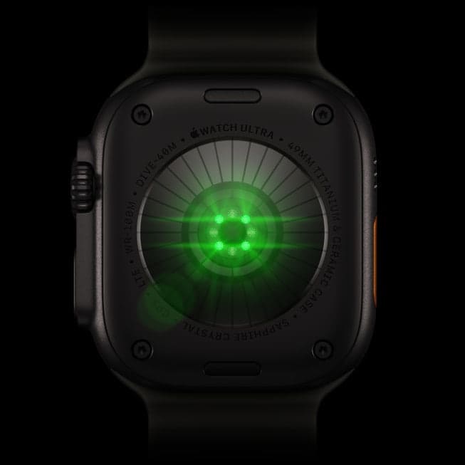 Apple Watch Ultra 4: Was Käufer in Deutschland für 899 Euro bekommen